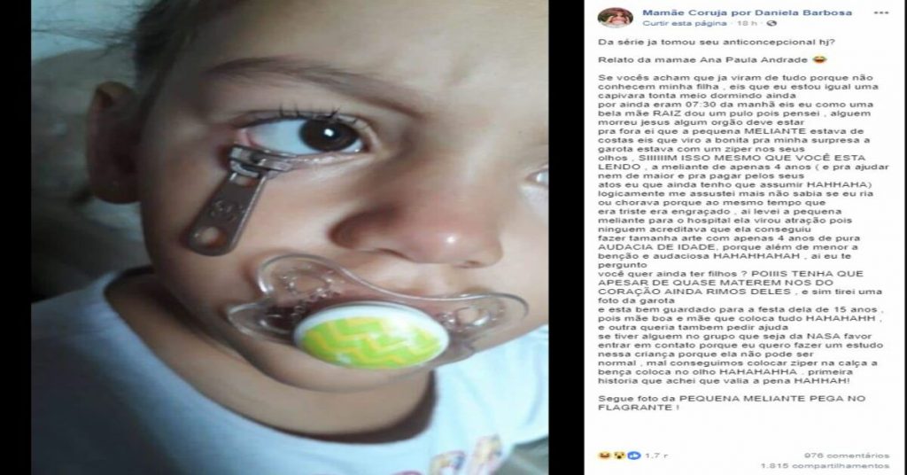 Menina De 4 Anos Coloca Zíper No Olho E Mãe Faz Um Relato Que Viralizou